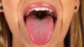 哈佛大学“国际禁招令”或加剧人才出走