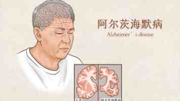 美致信“提醒”贸易伙伴加紧关税谈判